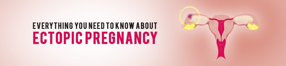 ectopic pregnancy, different types of ectopic pregnancy, early signs of ectopic pregnancy, ectopic pregnancy risk factors