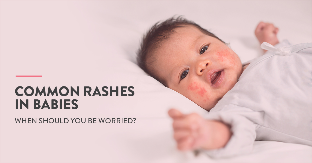 10 Common Skin Rashes in Children | The CK Birla Hospital