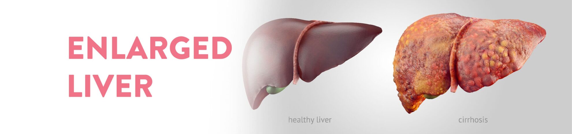 all-about-enlarged-liver-ck-birla-hospital