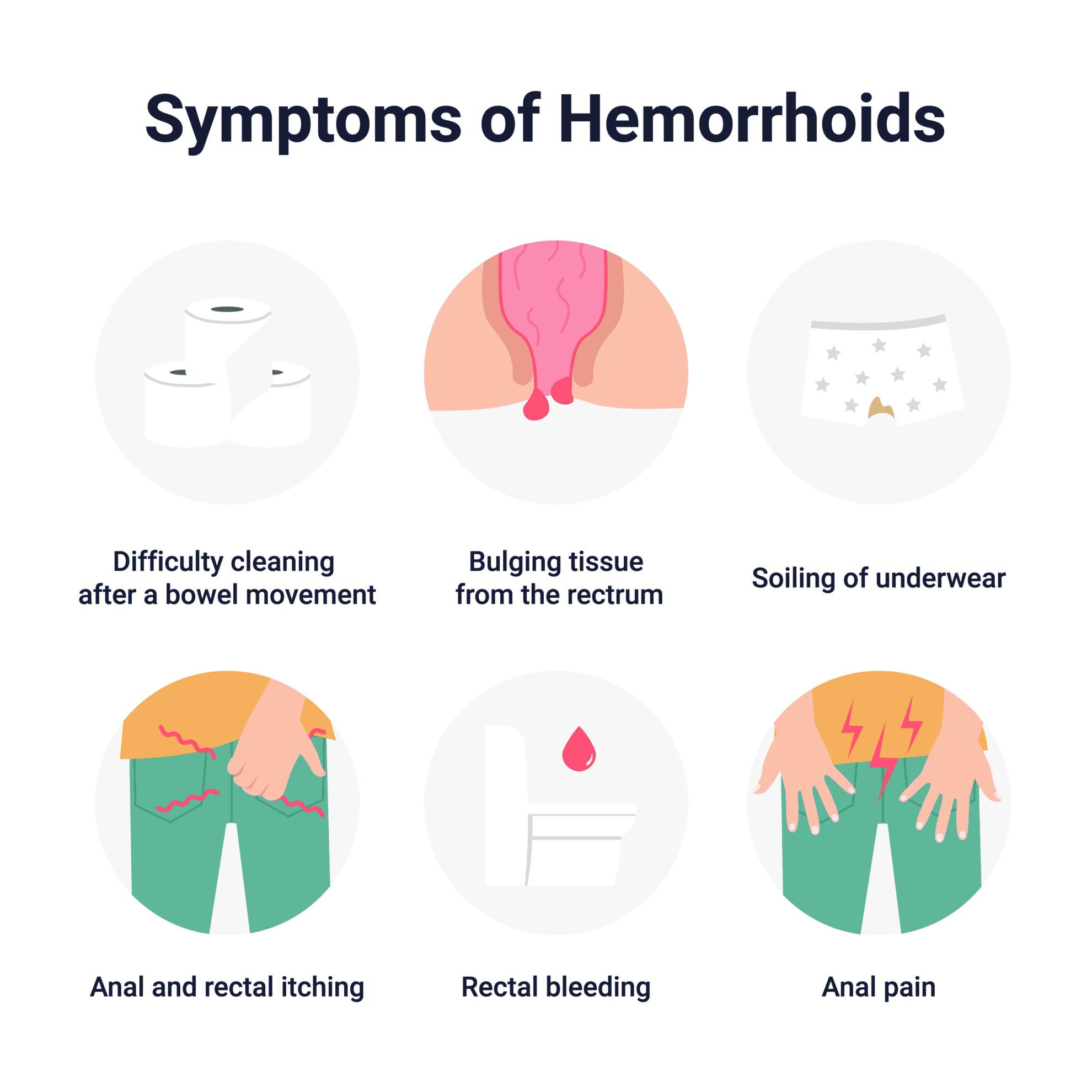 Piles Haemorrhoids Causes Symptoms Risk Factors And Treatment Ck Birla Hospital 8053