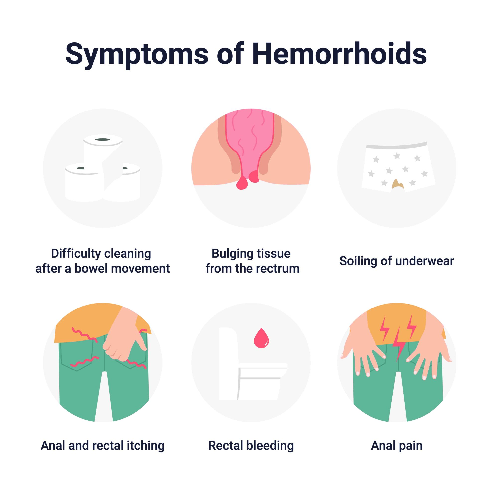 Piles Haemorrhoids Causes Symptoms Risk Factors And Treatment Ck Birla Hospital 2901