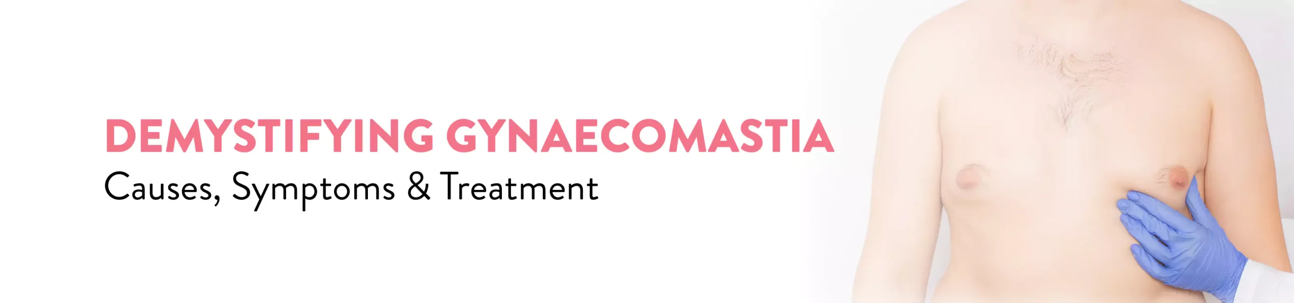 demystifying gynaecomastia causes symptoms ans treatment