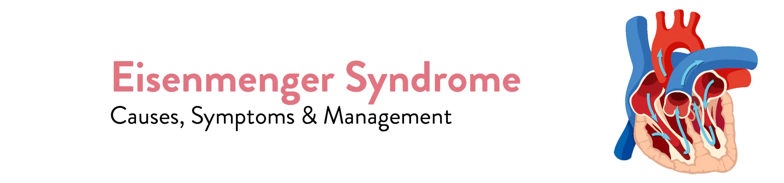 Eisenmenger syndrome causes symptoms and treatment