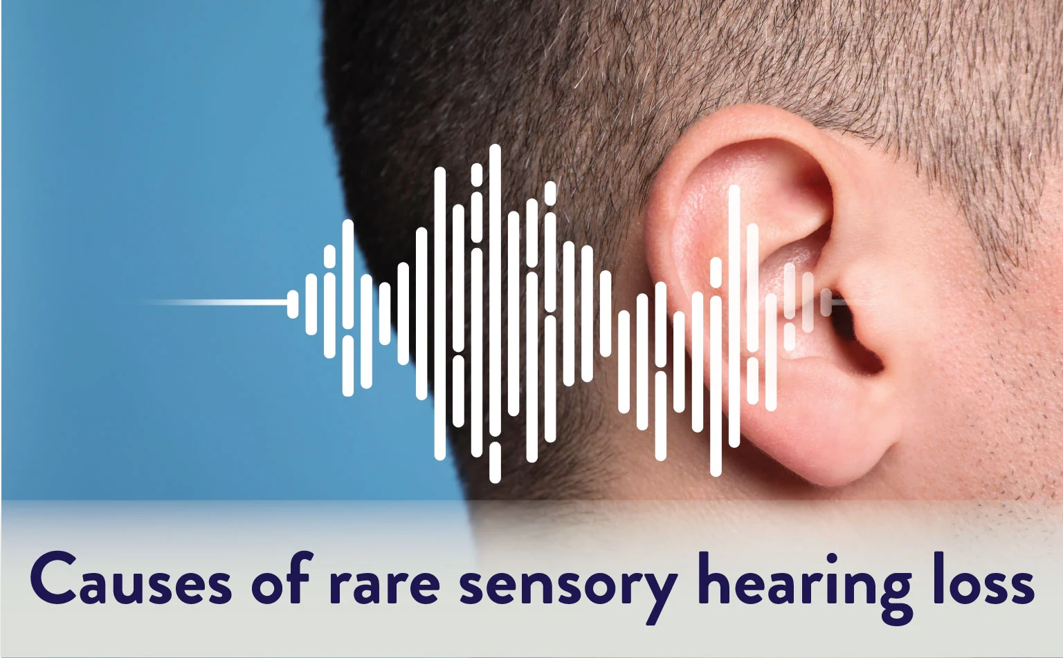 Causes-of-rare-sensory-hearing-loss