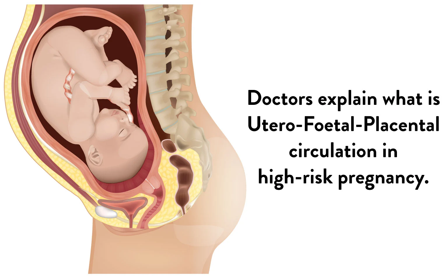 Utero Foetal Placental Circulation in high risk pregnancy